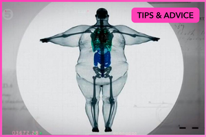 An x-ray of an obese person, showing body fat and bone structure